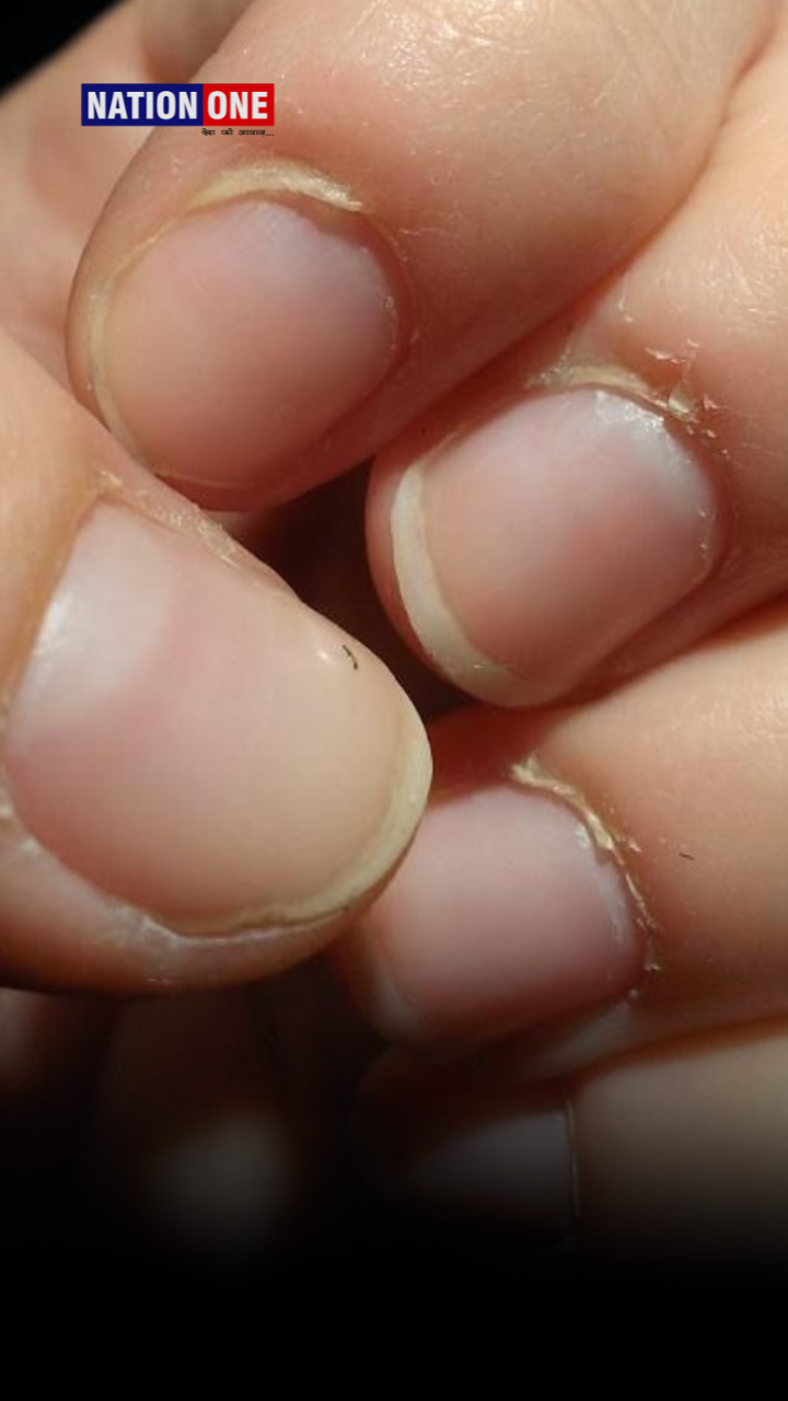 बैक्टीरिया का अड्डा