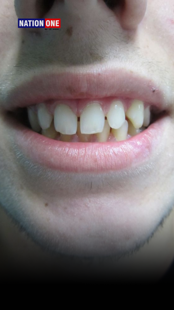 दांतों का दुश्मन