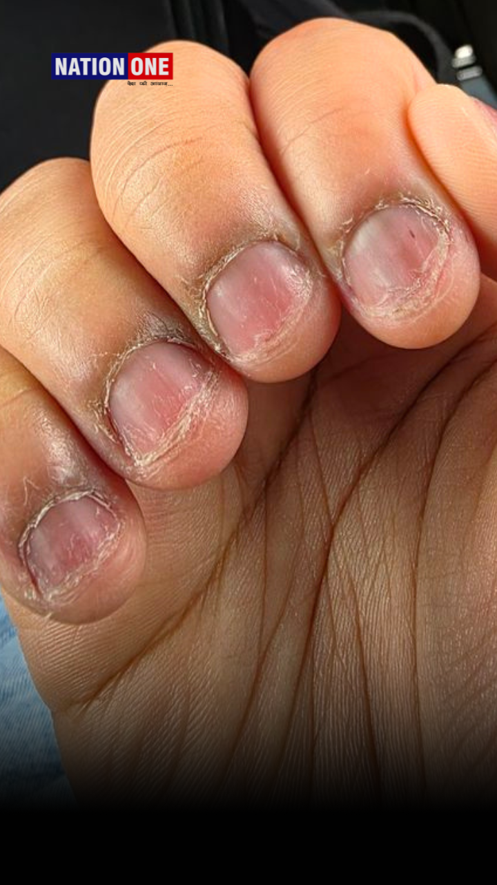 स्किन इन्फेक्शन का खतरा