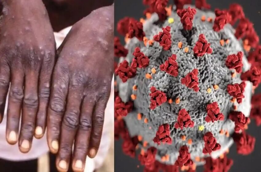  Monkeypox Death : देश में मंकीपॉक्स से पहली मौत, लक्षणों के साथ UAE से केरल लौटे युवक की गई जान | Nation One